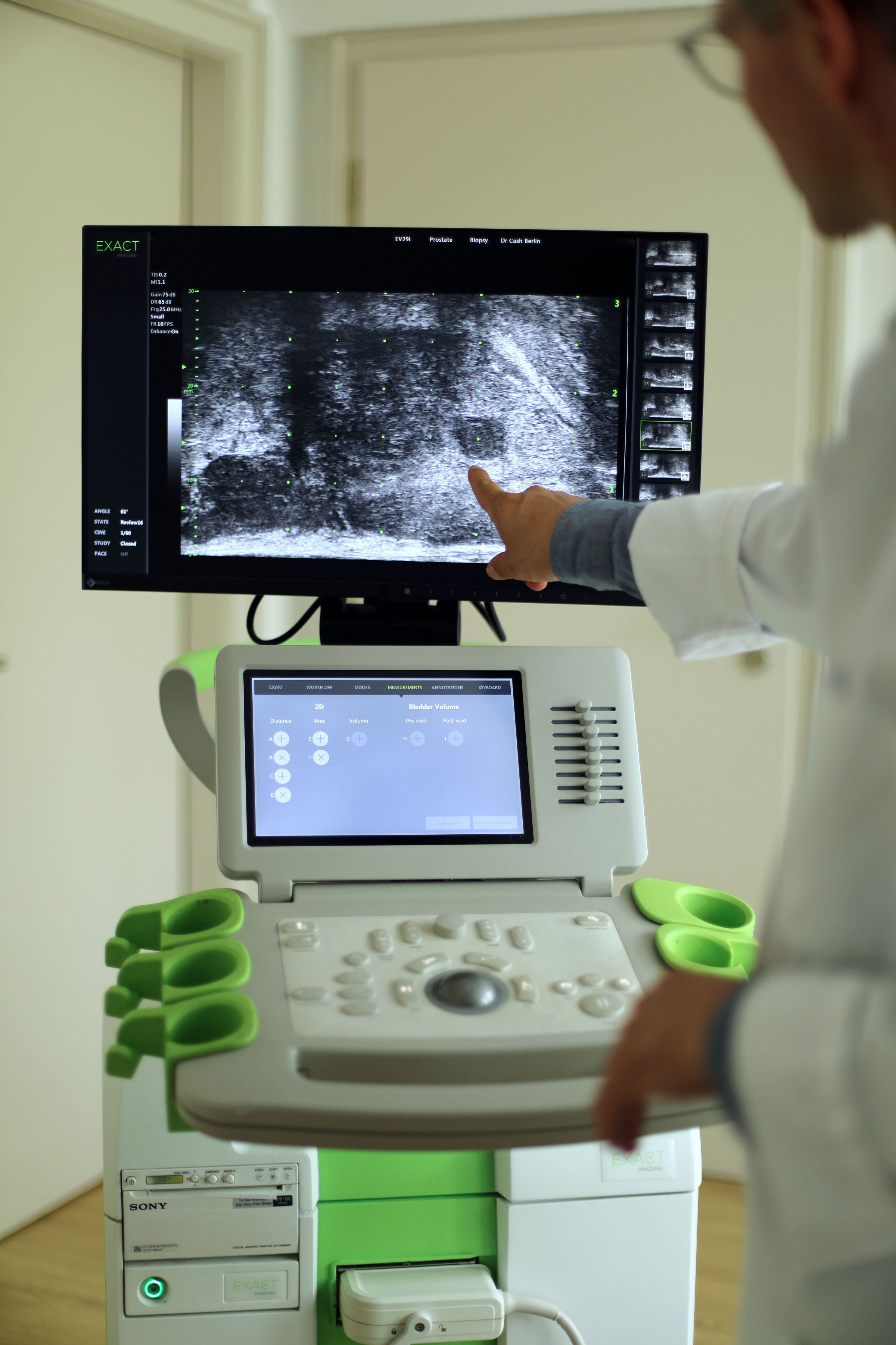 Urologe deutet auf den Monitor eines hochauflösenden Mikro-Ultraschallgeräts mit 29 MHz während einer Prostatauntersuchung