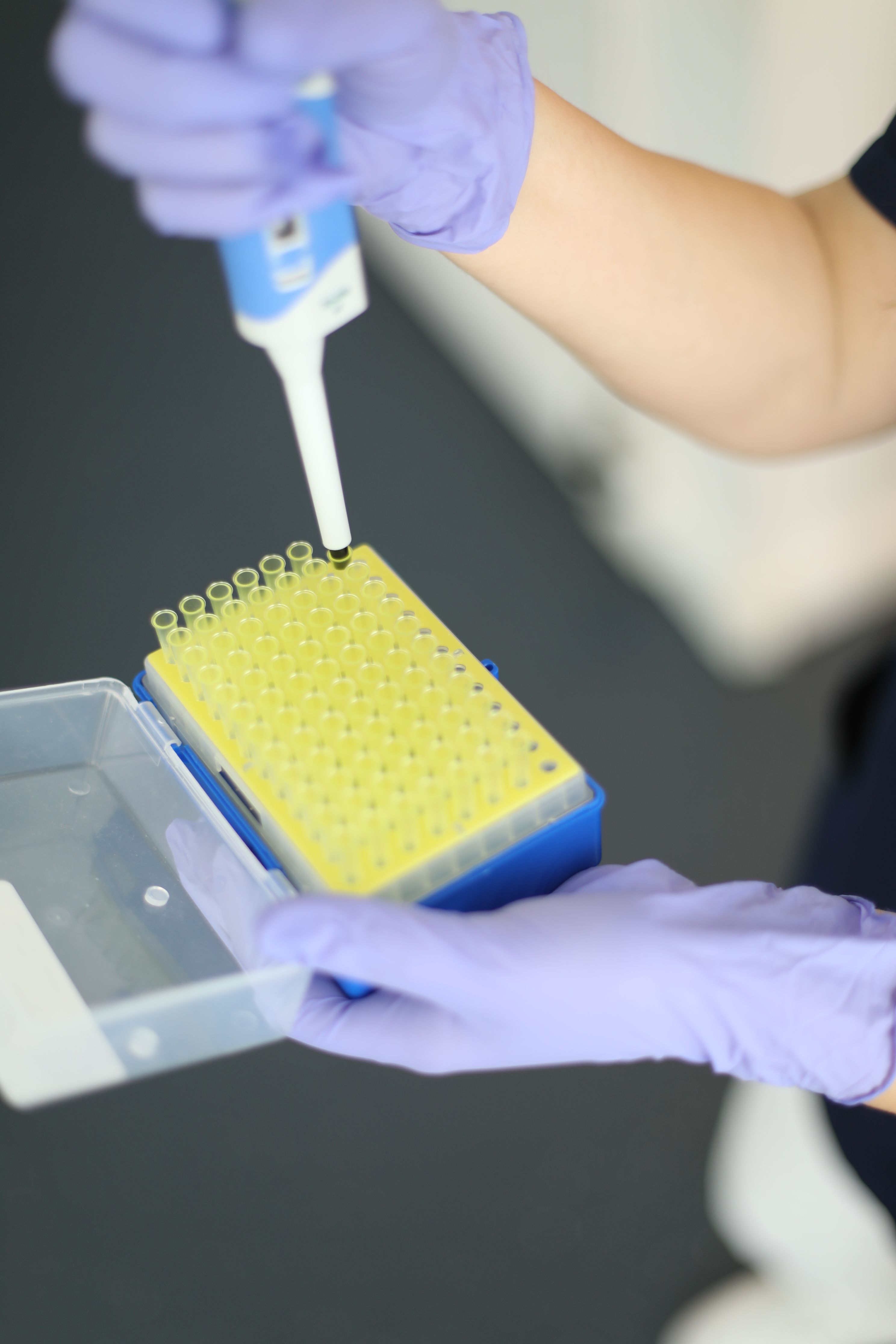Laborkraft pipettiert eine Probe in eine Mikrotiterplatte – Laboranalyse im Rahmen der urologischen Vorsorge bei ProUro